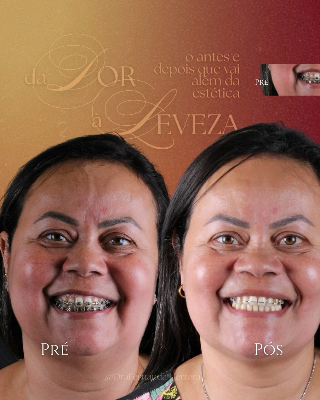 Instagram post from drafernanda.herrera. This post is in position 1.