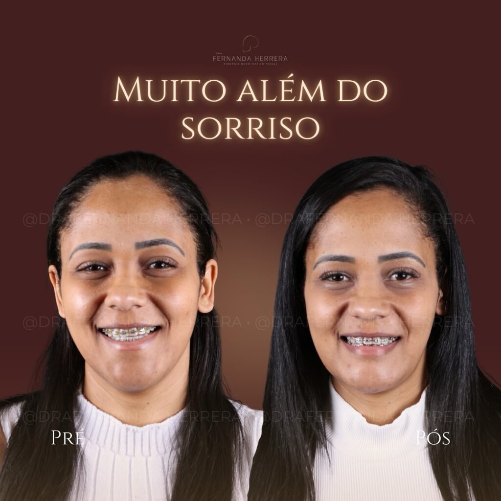 Instagram post from drafernanda.herrera. This post is in position 0.