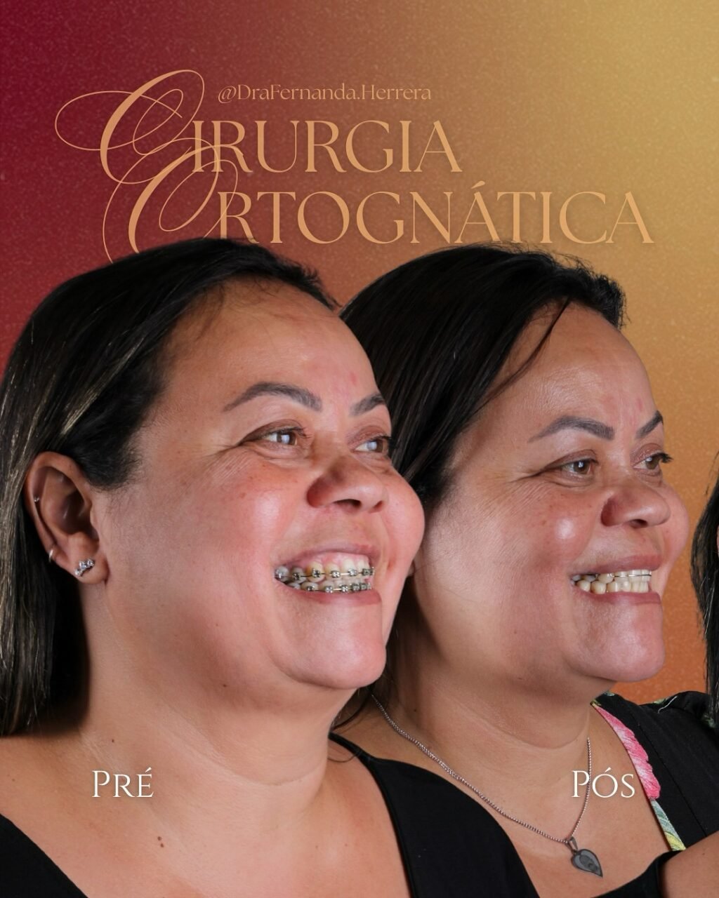 Instagram post from drafernanda.herrera. This post is in position 0.